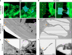 Correlative cryo-electron microscopy reveals the structure of TNTs in ...