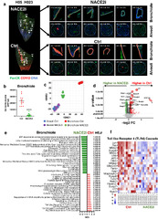 In vivo inhibition of nuclear ACE2 translocation protects against ...