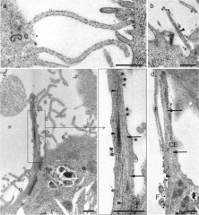 Ultrastructural analysis and three-dimensional reconstruction of ...