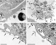 Ultrastructural analysis and three-dimensional reconstruction of ...