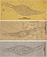 Genetic diversity of an avian nasal schistosome causing cercarial ...