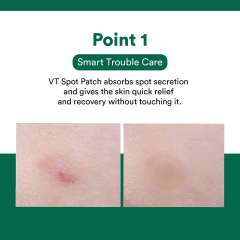 VT Cosmetics CICA CARE SPOT PATCH, Acne patch, Acne treatment ...