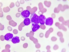 Clonal Hematopoiesis Risk Tool Predicts Possibility of Blood ...