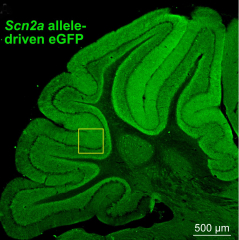 Understanding the Underpinnings of Sensory Hypersensitivity in ...