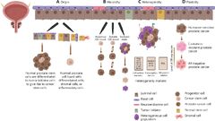 Therapeutic implications of cancer stem cells in prostate cancer ...