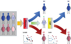 An interpretable machine learning model for diagnosis of Alzheimer's