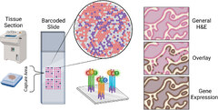 Frontiers | Spatial transcriptomics in glioblastoma: is knowing ...