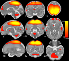 Prenatal neural origins of infant motor development: Associations ...