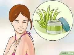 How to Get Rid of a Sunburn: 10 Steps (with ) - wikiHow